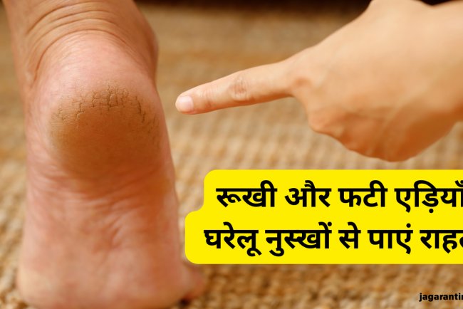 रूखी और फटी एड़ियों से आप भी हैं परेशान, तो आजमाएं ये 5 घरेलू नुस्खे; जल्द मिलेगा आराम