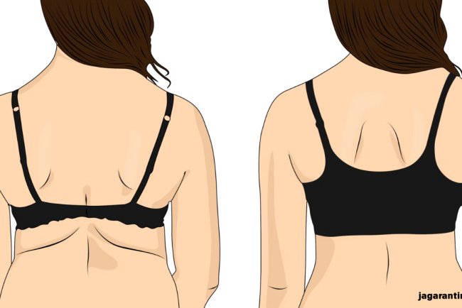 Bra Fat ने ब‍िगाड़ द‍िया है आपका लुक, रोजाना करें 6 एक्‍सरसाइज; देखते ही देखते गायब हो जाएगी चर्बी