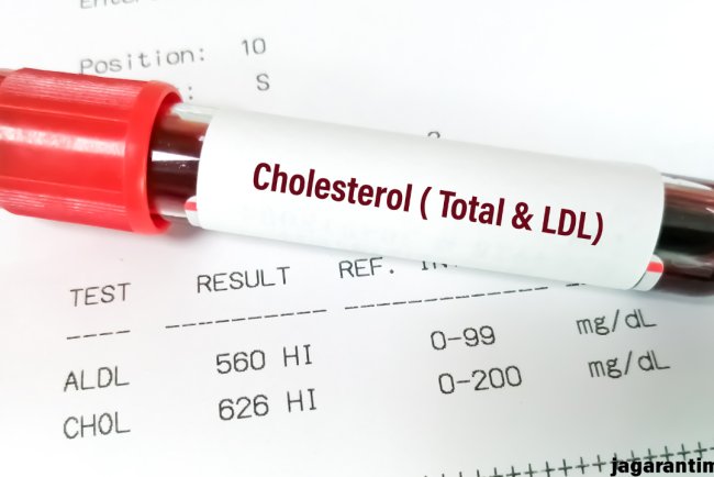 बढ़े हुए कोलेस्ट्रॉल को कम करने के लिए रोजाना पिएं 5 तरह के जूस, साफ हो जाएगा नसों में भरा गंदा LDL