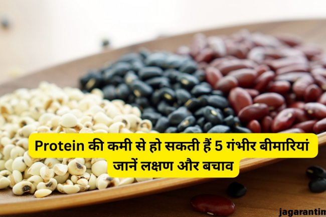 Protein की कमी से हो सकती हैं 5 बीमार‍ियां, समय रहते पहचान लें लक्षण; बचाव में होगी आसानी