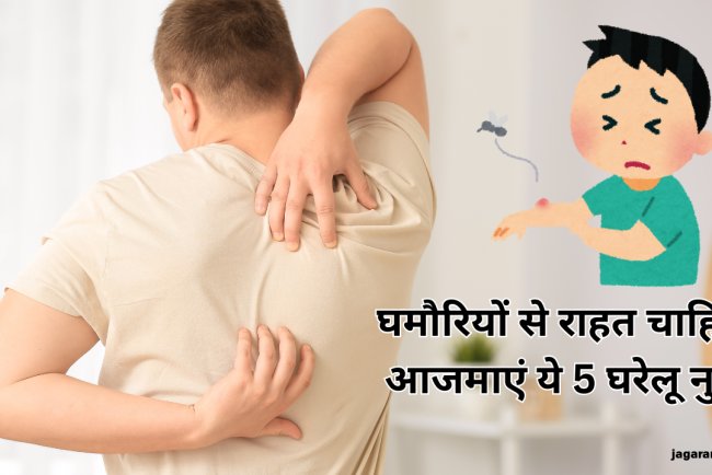 गर्मी में घमौर‍ियों ने कर द‍िया है परेशान, तो आजमाएं 5 घरेलू नुस्खे; दो द‍िन में दूर हाेगी द‍िक्‍कत