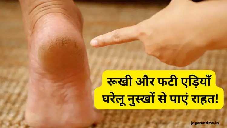 रूखी और फटी एड़ियों से आप भी हैं परेशान, तो आजमाएं ये 5 घरेलू नुस्खे; जल्द मिलेगा आराम
