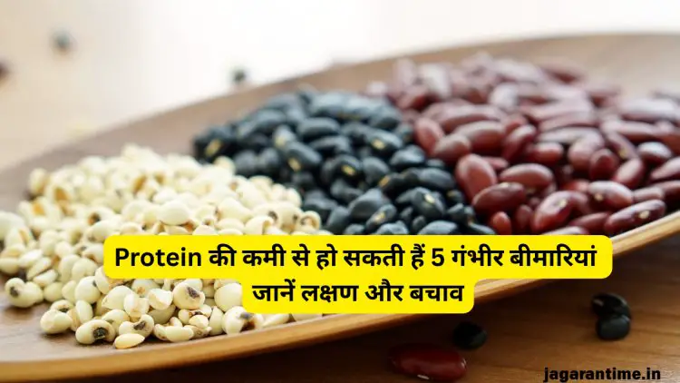 Protein की कमी से हो सकती हैं 5 बीमारियां, समय रहते पहचान लें लक्षण; बचाव में होगी आसानी
