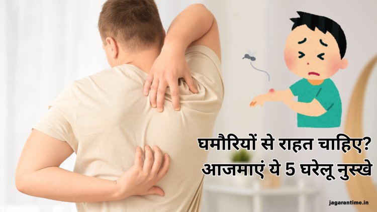 गर्मी में घमौरियों ने कर दिया है परेशान, तो आजमाएं 5 घरेलू नुस्खे; दो दिन में दूर हाेगी दिक्कत